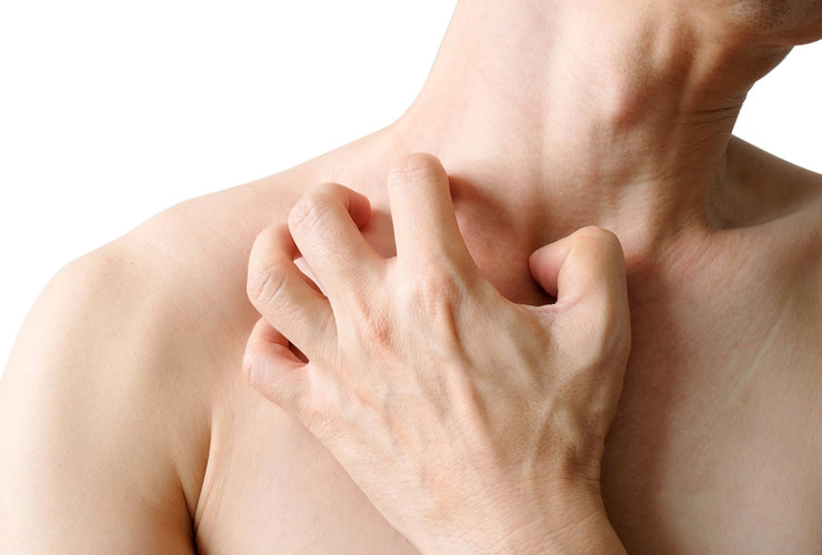 Prečo sladkosti zhoršujú svrbenie pokožky?>