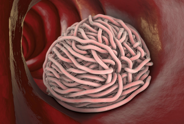 Mrľa detská: Príznaky, test, a liečba>
