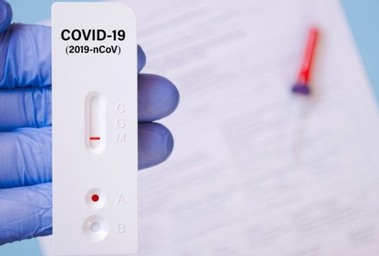 Informácie k testovaniu na COVID 19