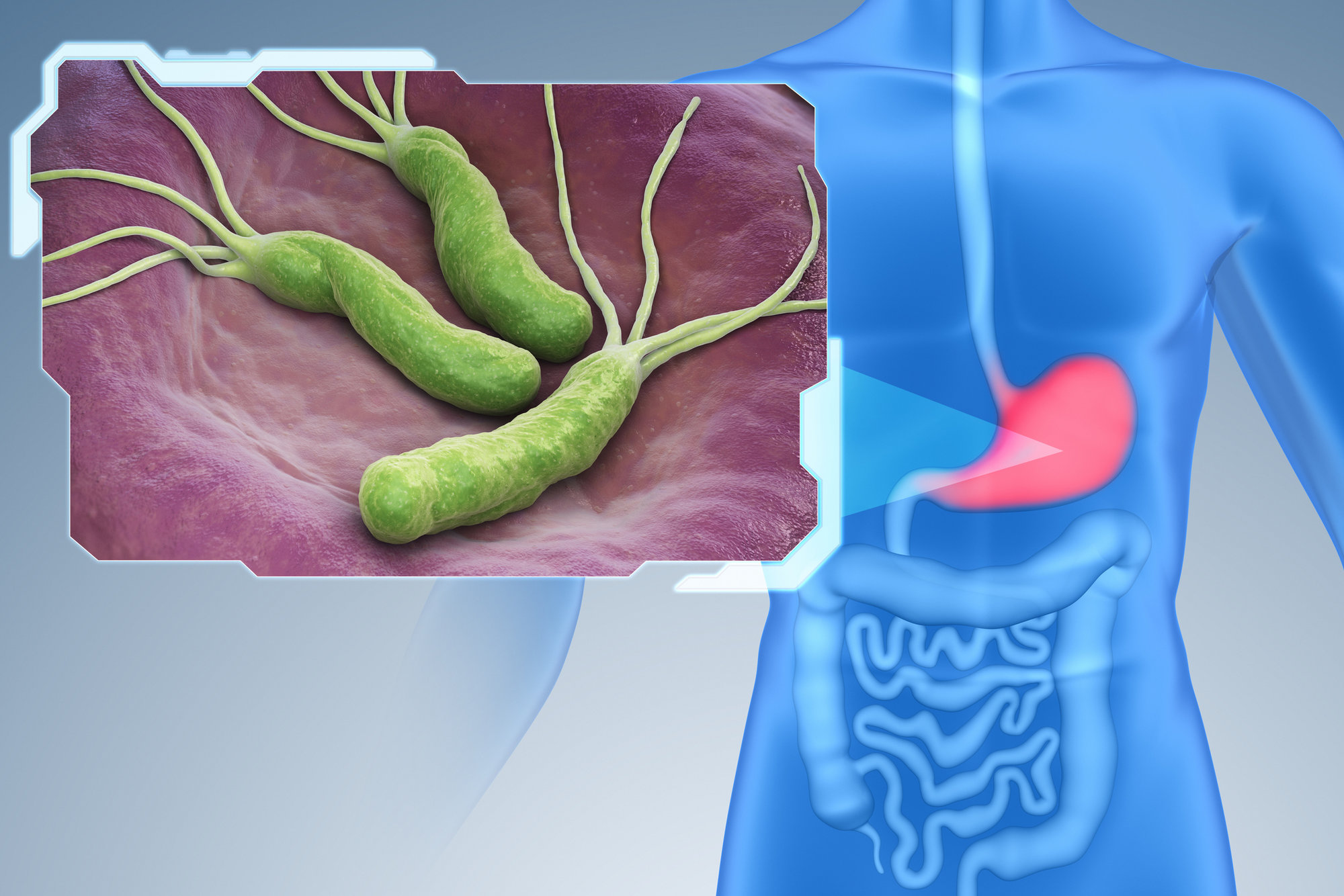Helicobacter pylori nákres v žalúdku 